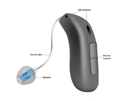 Can DSP Family Truly Redefine Hearing Aid Technology?